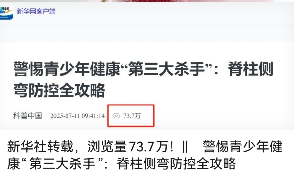 新华社转载，浏览量73.7万！|| 警惕青少年健康“第三大杀手”：脊柱侧弯防控全攻略
